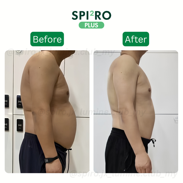 Before and After