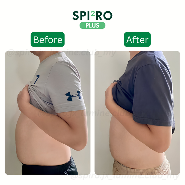 Before and After