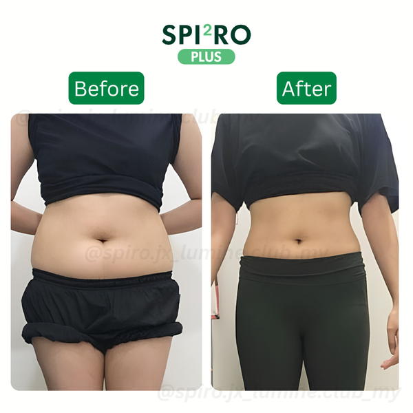 Before and After
