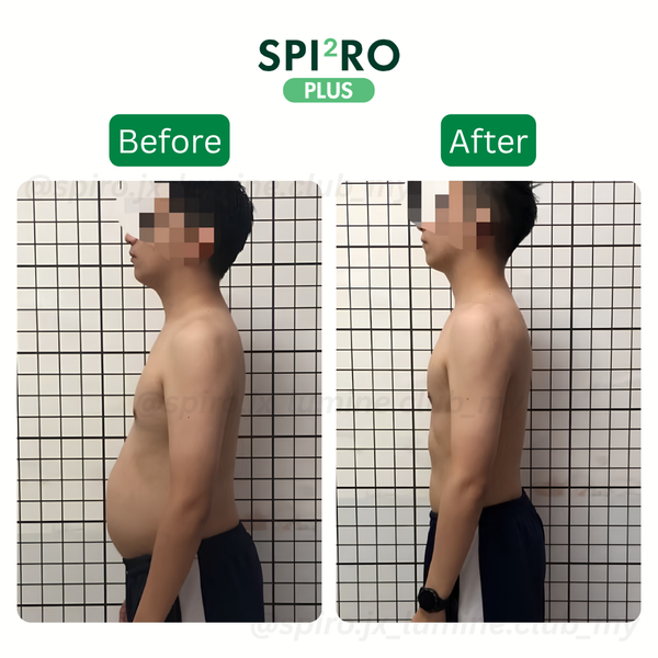Before and After