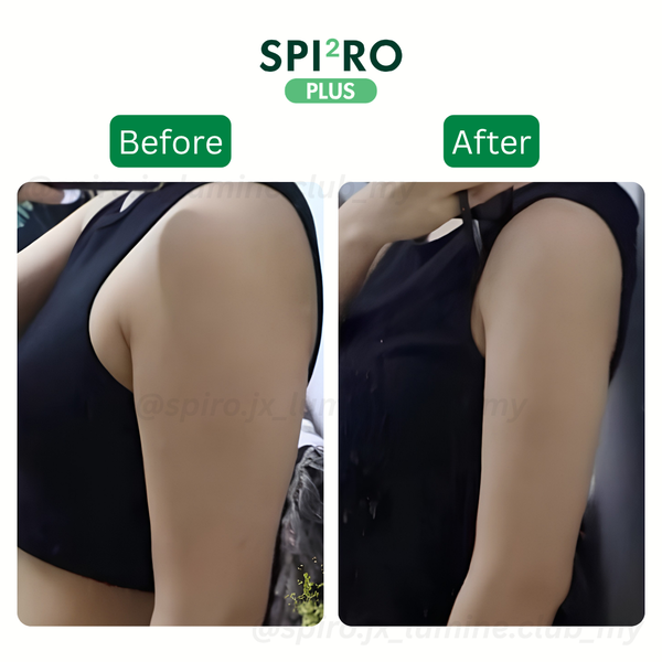 Before and After