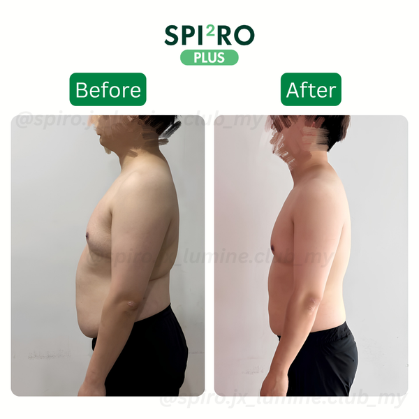 Before and After