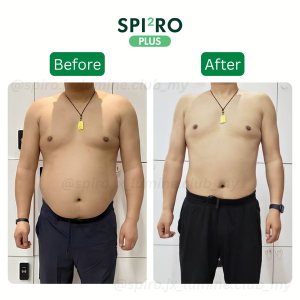 Before and After