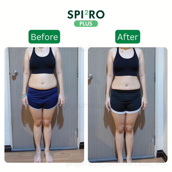 Before and After