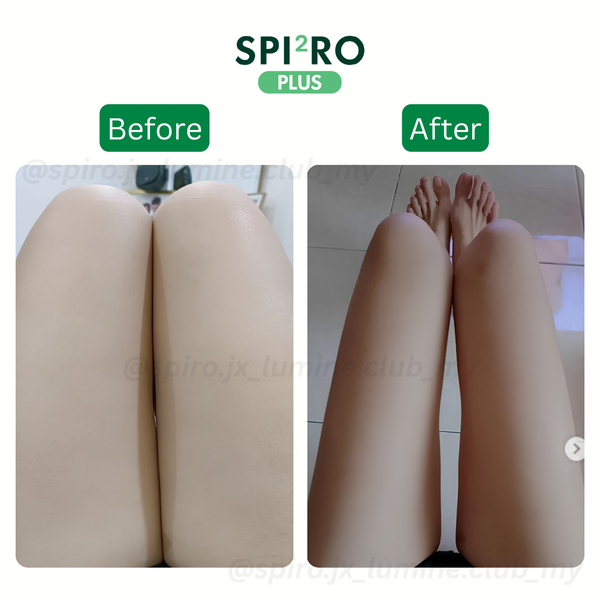 Before and After